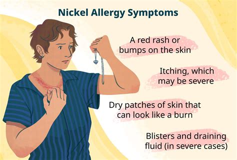 Nickle Allergy 